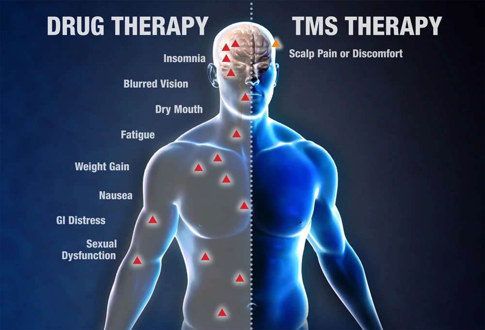 tms_therapy